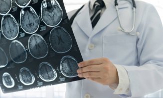 O terapie pentru o boală a creierului ar putea creşte riscul de cancer